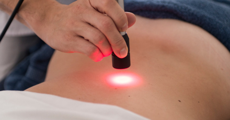 Laserterapia ad alta potenza