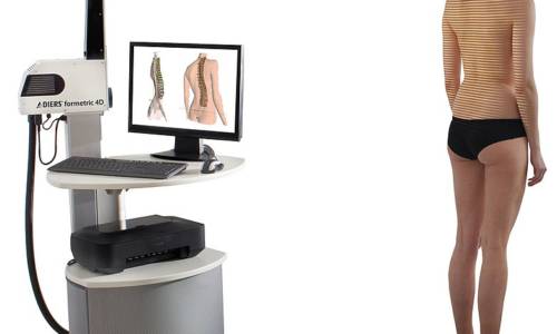 Formetric, una nuova frontiera per diagnosi e cura delle patologie vertebrali