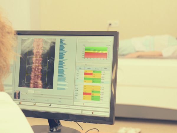 L’osteoporosi, malattia silenziosa: quando prevenire è vitale