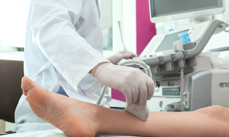 Caldo e gambe gonfie: la parola allo specialista