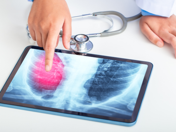 Respira bene, vivi meglio: il nostro Ambulatorio di Pneumologia