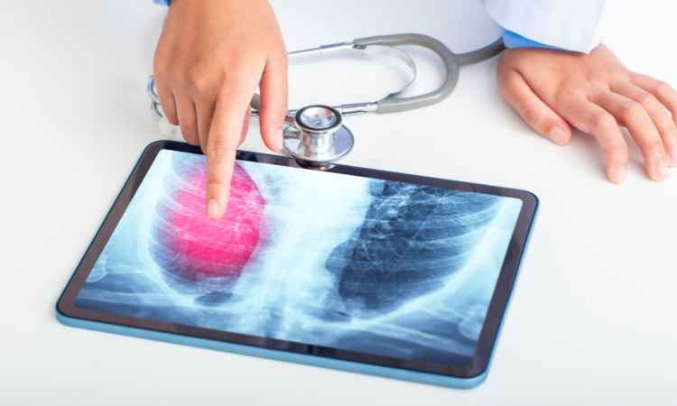 Respira bene, vivi meglio: il nostro Ambulatorio di Pneumologia