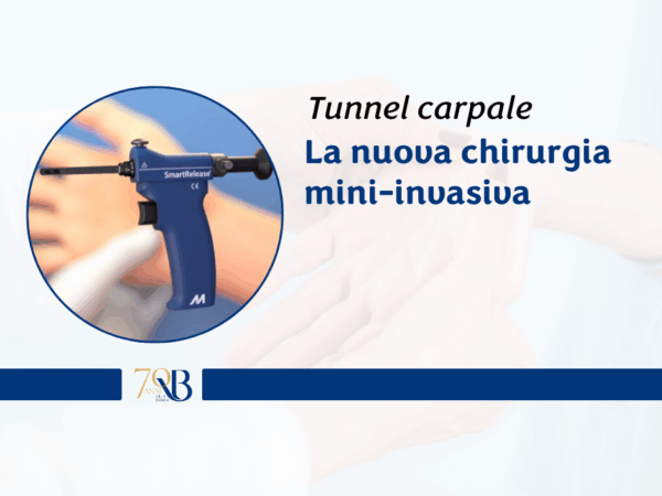 Tunnel carpale: la nuova chirurgia mini-invasiva che riduce dolore e tempi di recupero
